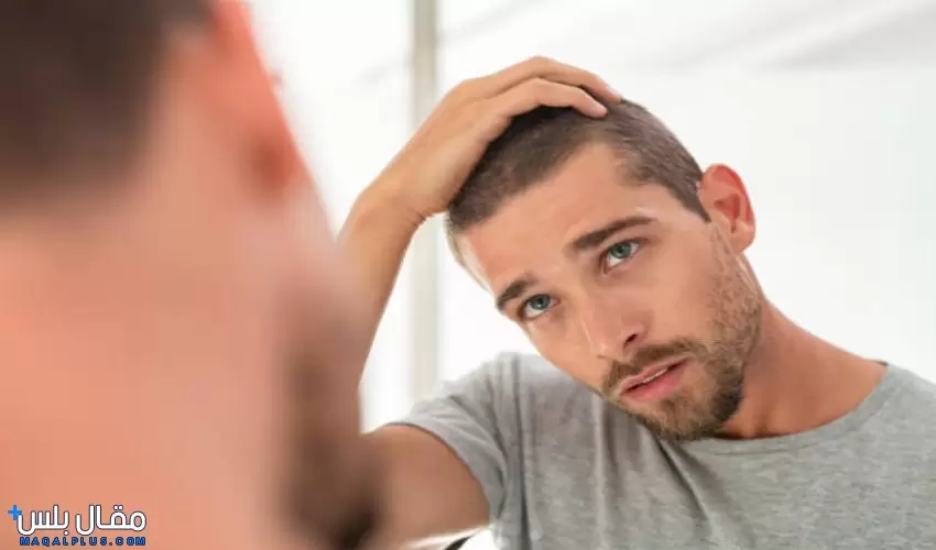 علاج تساقط الشعر للرجال (1)