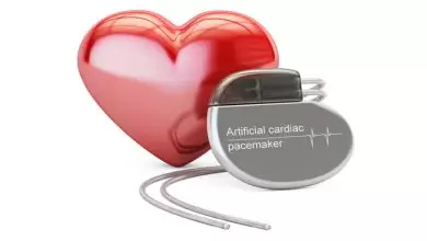 ما هو جهاز منظم ضربات القلب