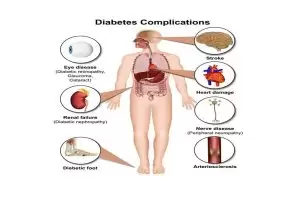 مضاعفات السكر عند الرجال والنساء