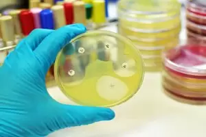 ما الغرض من مزرعة البول؟