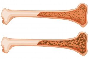 ما هو نخاع العظم؟