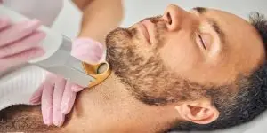 ازالة الشعر بالليزر