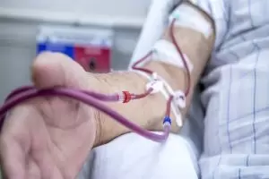 الغسيل الكلوي سؤال وجواب