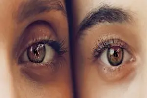 ما هي أعراض الجلوكوما عند الشباب؟