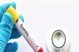 ما هو تحليل الزهري بالتفصيل؟