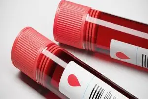 ما هو تحليل حمى البحر المتوسط بالتفصيل؟