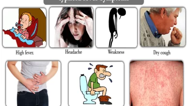 ما هي اعراض حمى التيفود؟