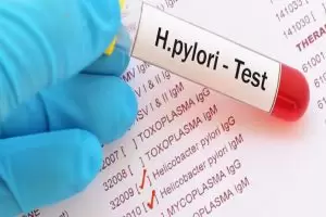 أنواع تحليل جرثومة المعدة