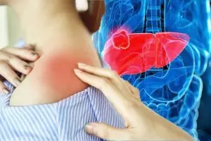 اعراض سرطان الكبد بالتفصيل