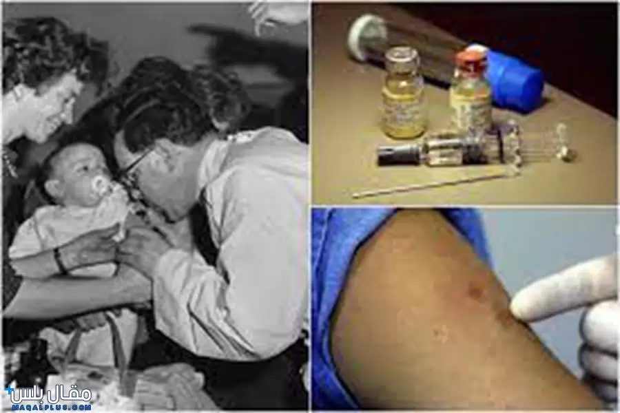 جرعات تطعيم الجدري