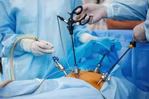 أيهما أفضل استئصال المرارة بالمنظار أم الجراحة؟