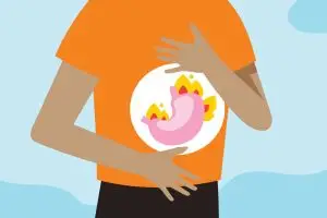 اعراض ارتجاع المرئ GERD بالتفصيل