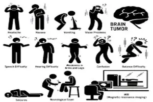 اعراض سرطان المخ بالتفصيل