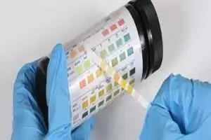 اختبار سكر البول