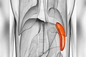 سرطان الطحال بالتفصيل