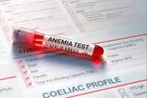 أنواع تحليل الانيميا بالتفصيل