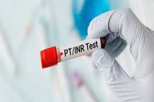 تحليل PT أو اختبار زمن البروثرومبين
