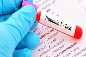 تحليل تروبونين Troponin