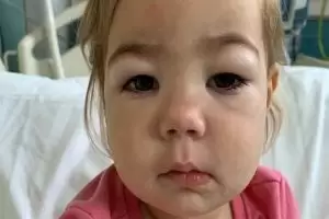 أعراض المتلازمة الكلوية عند الأطفال