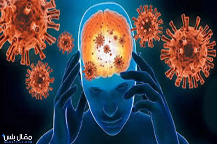 التهاب السحايا Meningitis بالتفصيل