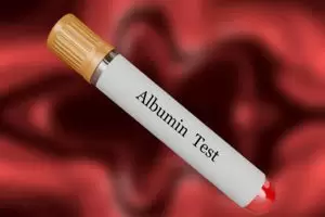 تحليل الألبومين في الدم